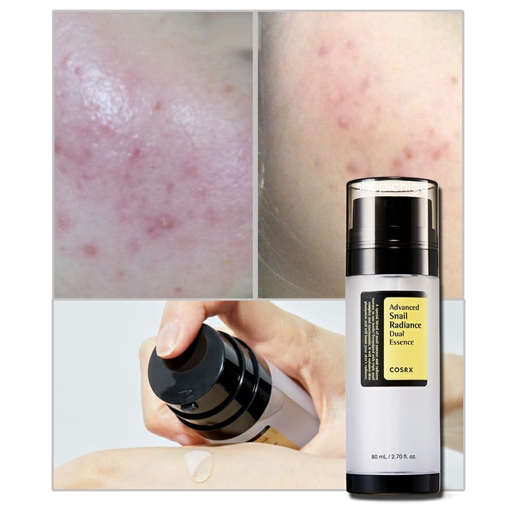 Tinh chất ốc sên dưỡng trắng COSRX ADVANCED SNAIL RADIANCE DUAL ESSENCE