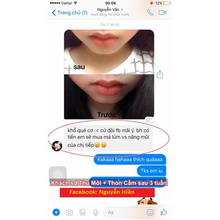 Tinh Chất Thon Gọn Môi Miracle