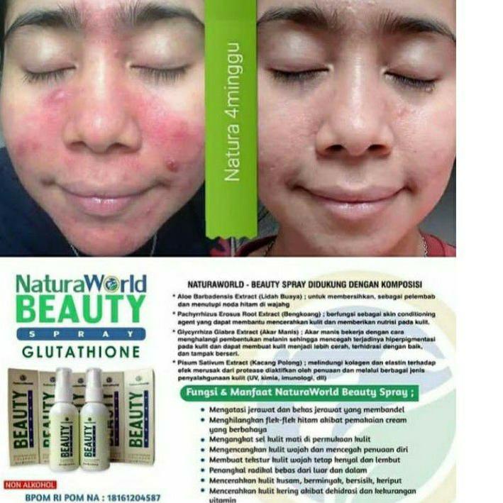 Cái thứ hai này! Tấm trải giường phun sương làm đẹp Lr075 Natura NBS Beuty Biuty Sprey Natura | BigBuy360 - bigbuy360.vn