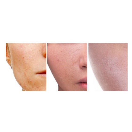 Serum vàng 24k - Serum dưỡng trắng da dưỡng ẩm tinh chất vàng 24k cao cấp 100ml