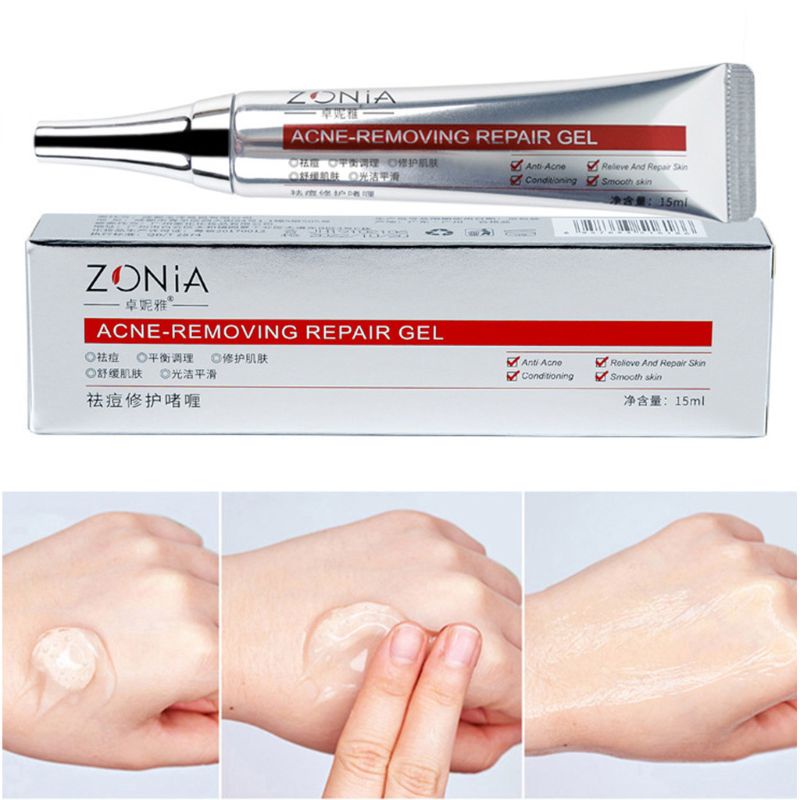 Gel Hỗ trợ giảm mụn đầu đen kiểm soát dầu làm trắng da 15ml Xixi
 | BigBuy360 - bigbuy360.vn