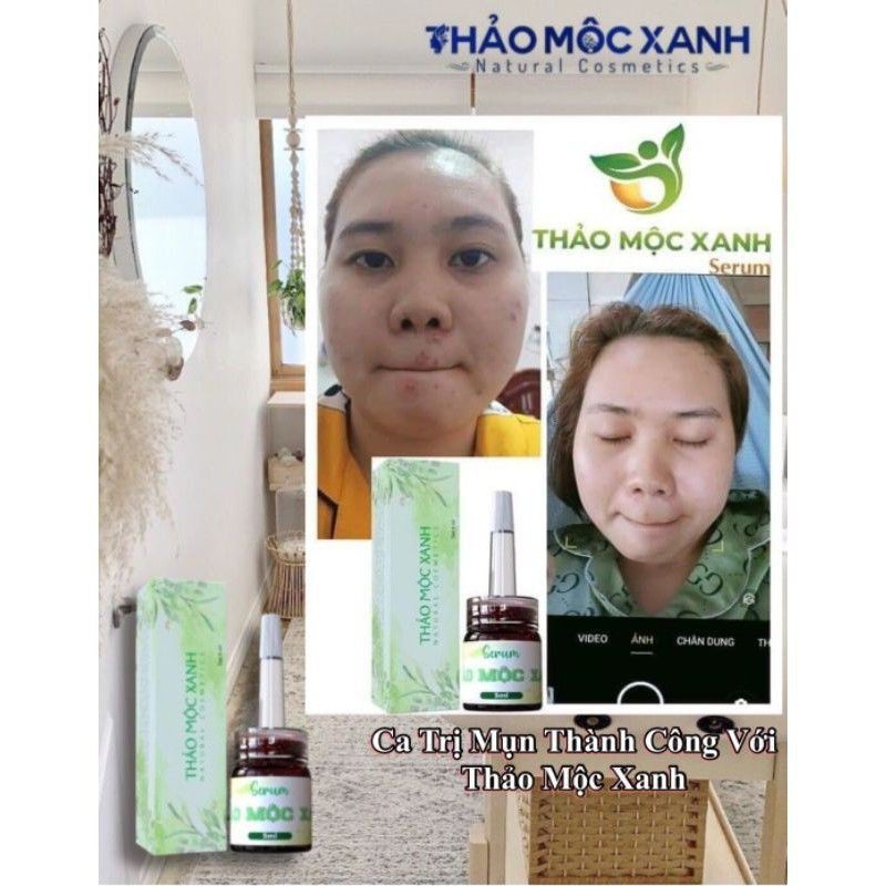 [ CHÍNH HÃNG]SERUM THẢO MỘC XANH