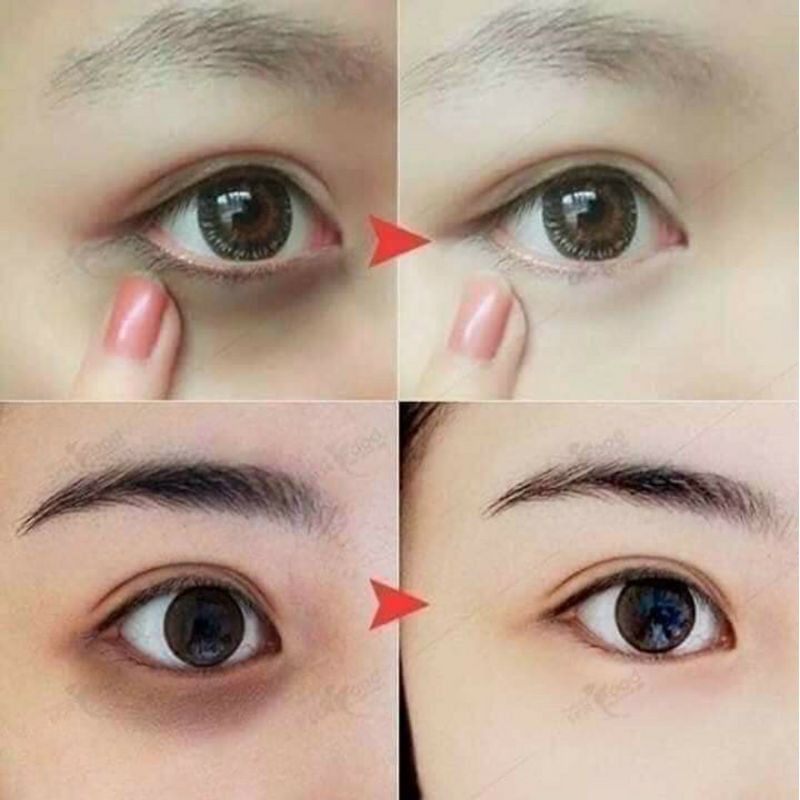 Kem dưỡng tái sinh và nâng cao đàn hồi vùng da mắt Whoo Cheongidan Radiant Regenerating Eye Cream 5ml
