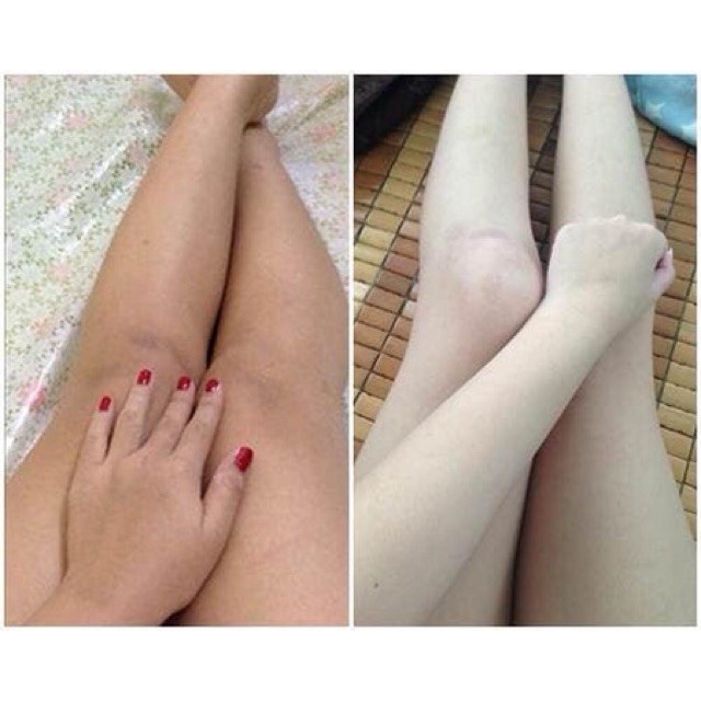 Combo 02 Chai  Sữa tắm Hoa hồng tươi kèm bổ xung Vitamin E - Cty AnAn.