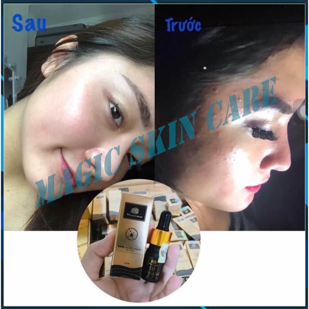 [ HÀNG CHÍNH HÃNG ] Serum trị mụn  Sake Acnes Liquid Magic Skin