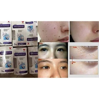 Thuốc Xóa Nốt Ruồi - Mụn Thịt - Mụn Cóc - Mụn cơm