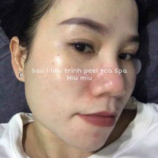 PEEL THAY DA MẶT TCA_USA