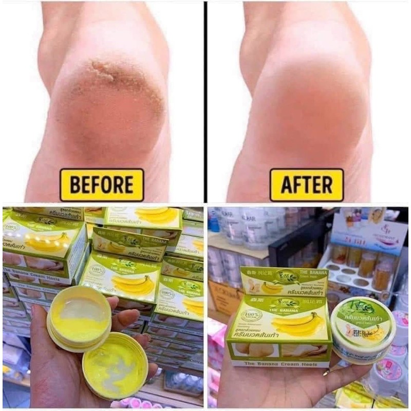 Kem nứt gót chân chuối Thái Lan ❤️