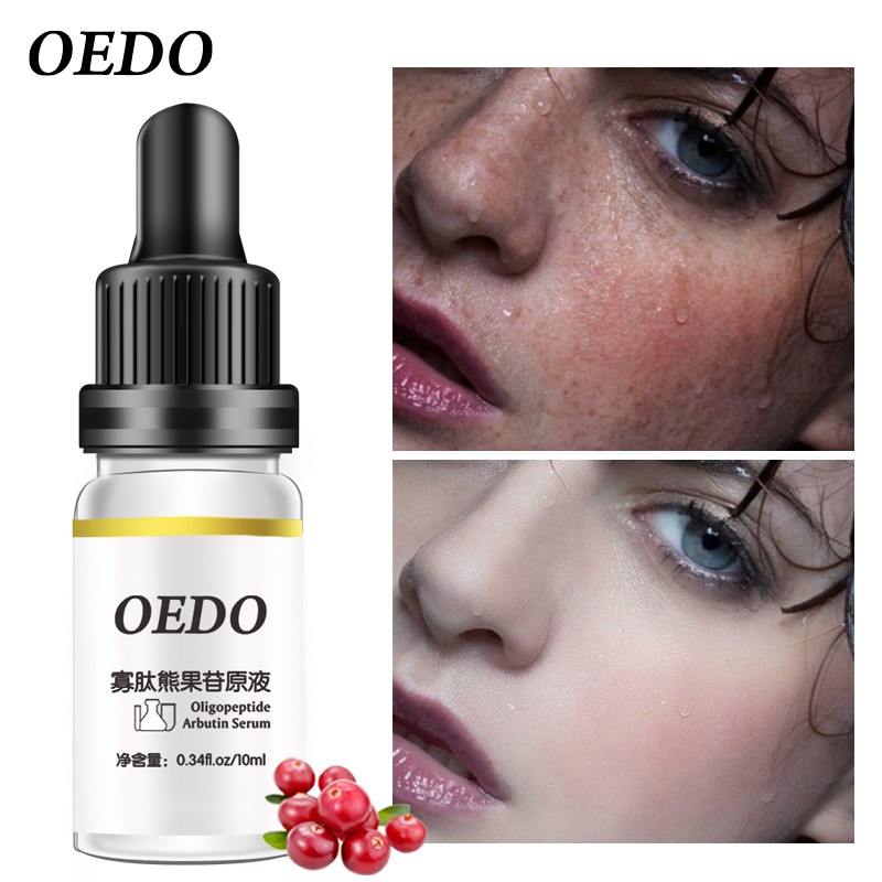 Serum dưỡng ẩm làm trắng da chống lão hóa/nếp nhăn OEDO