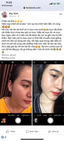 Serum LUMOS ACNE..