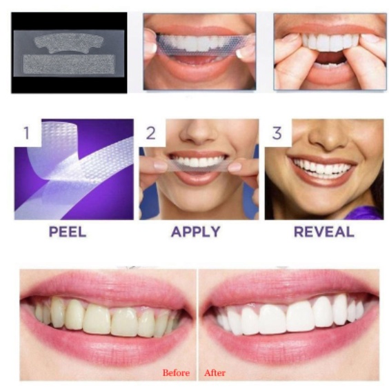 Miếng dán trắng răng 3D White Teeth Whitening Strips hàng nội địa Trung