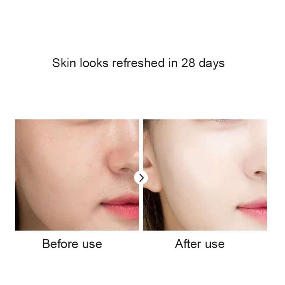 Bộ 20 Mặt Nạ Thạch Collagen Se Khít Lỗ Chân Lông Dưỡng Ẩm Làm Săn Chắc Da
