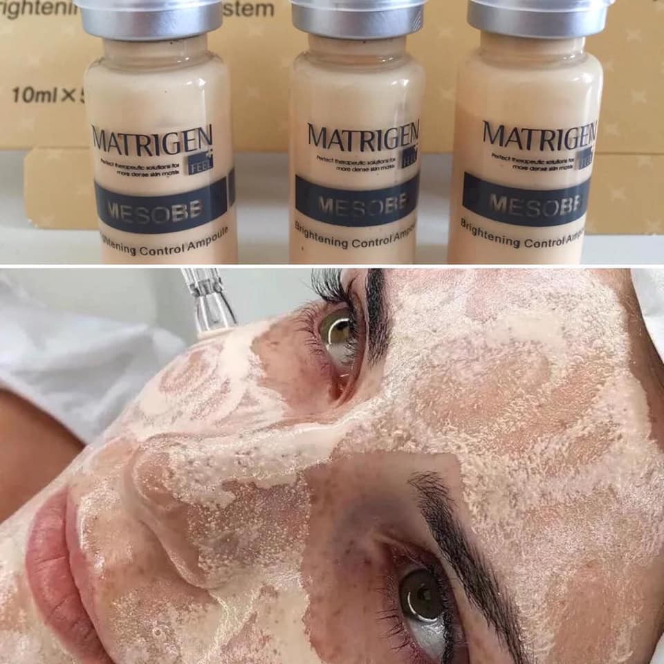 [Chính Hãng Hàn Quốc] CẤY PHẤN MESO BB HÀN MATRIGEN | BigBuy360 - bigbuy360.vn