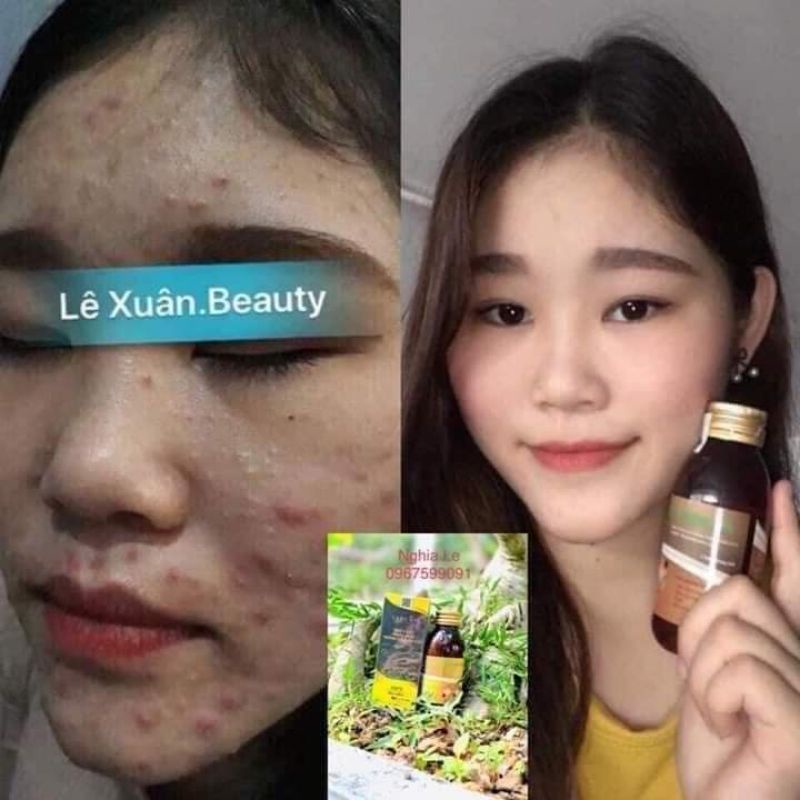 Thảo Dược Đông Y Lê Xuân🍒Trắng Da-Kiềm dầu-Mờ Thâm Nám | BigBuy360 - bigbuy360.vn