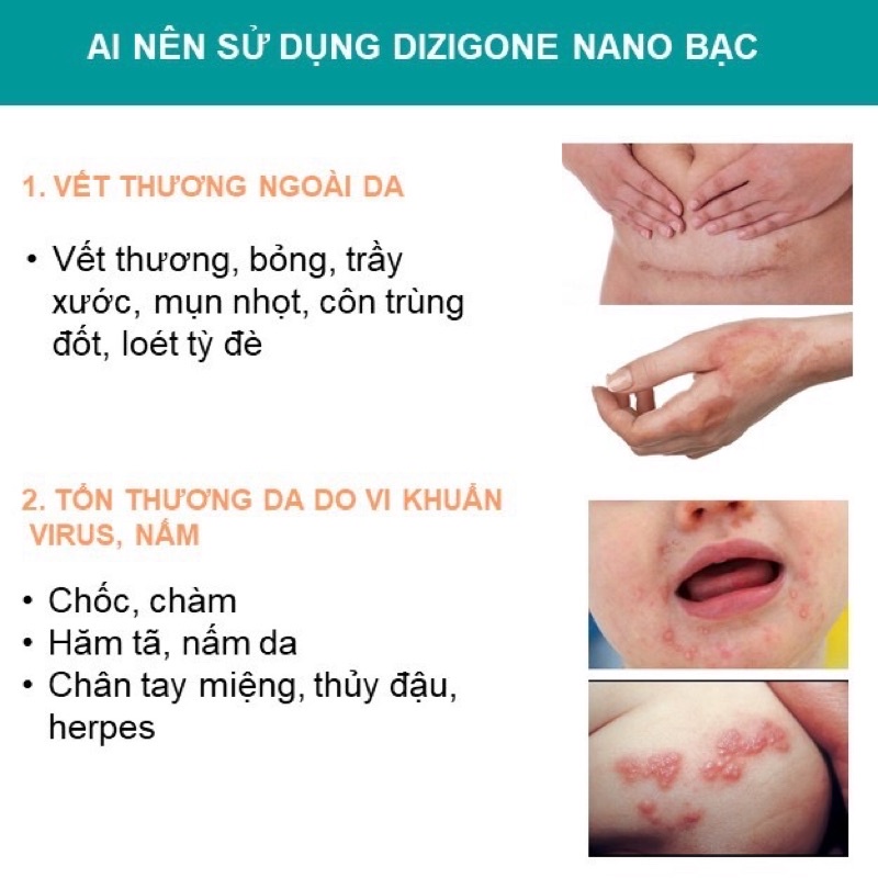 Dizigone spray 100ml xịt kháng khuẩn, tái tạo da, ngăn ngừa sẹo - CN106