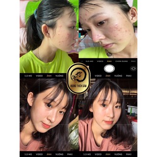 COMBO Hoàng Thiên Sâm Phiên Bản Vip