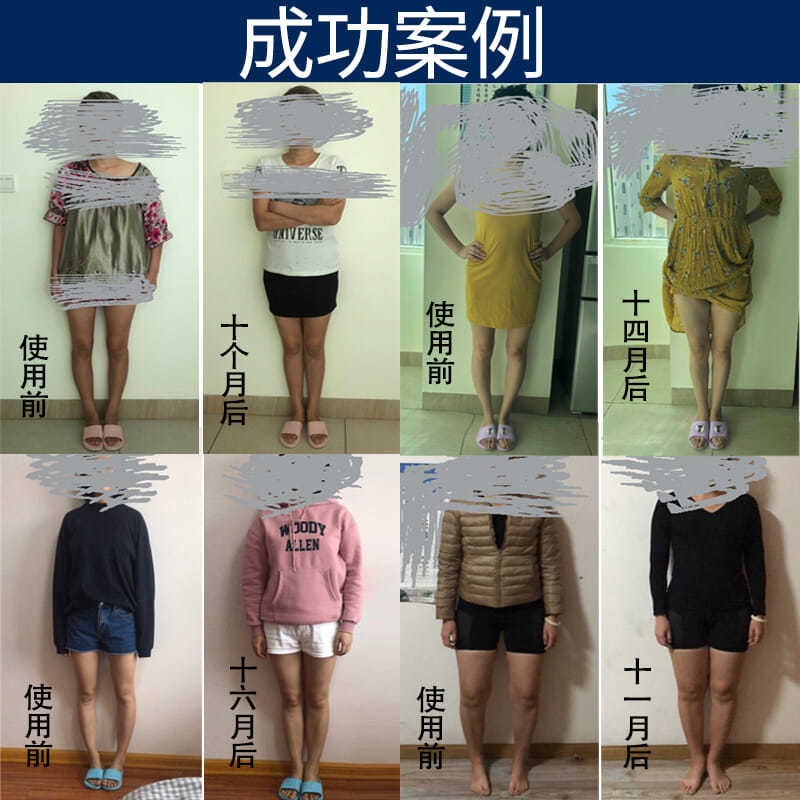 Dụng Cụ Chỉnh Hình Chân Kiểu Chữ O Và Thẳng Tám Khớp Ngón Chân Từ Tính Kiểu Chữ O