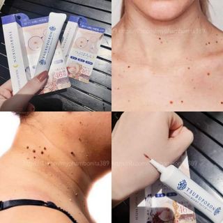 KEM MỜ NỐT RUỒI TSUBUPORON NIGHT PATCH