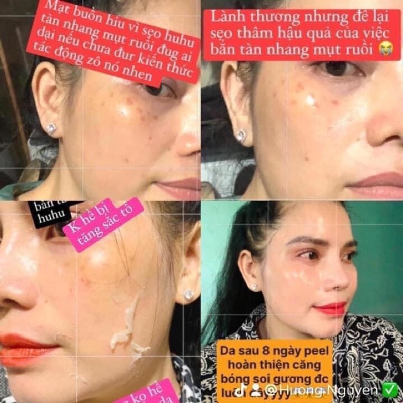 Feel Thay Da Mới Tảo Sâm MEEA - Tái Tạo Không Sưng Đỏ Da.