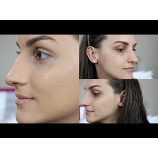 Kem nền Elf Acne Fighting foundation