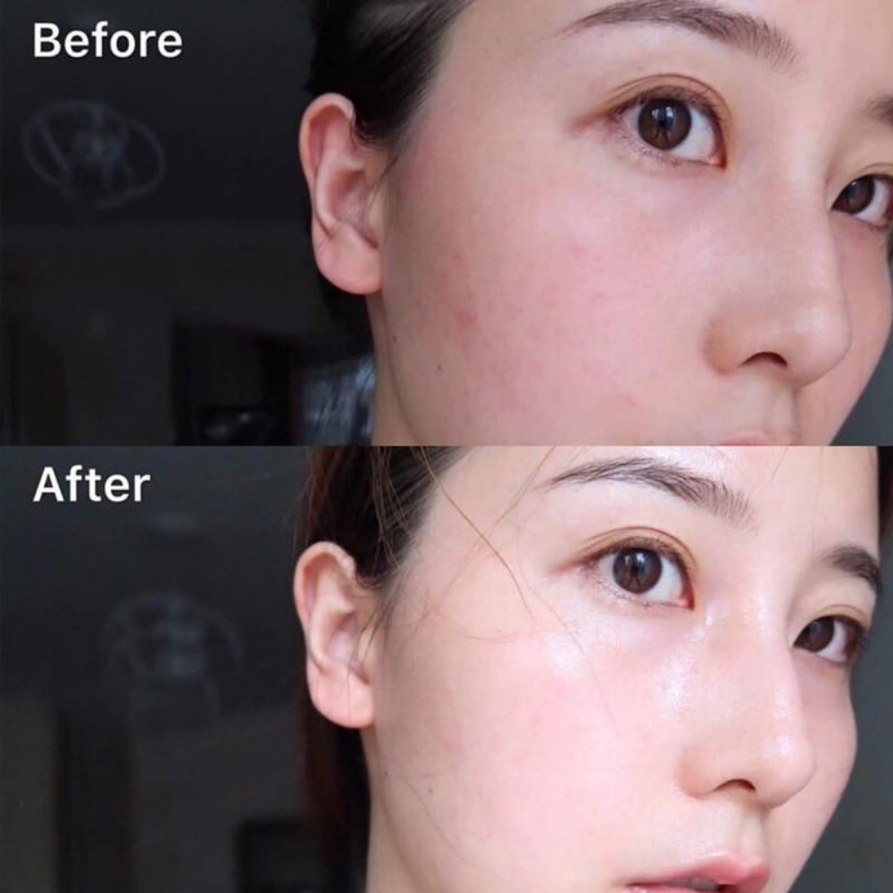 (Date 05/2024) Kem chống nắng ALTRUIST Dermatologist Sunscreen Face Fluid SPF50 50ML phù hợp cho da nhạy cảm