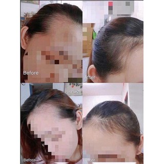 Thuốc mọc tóc sato