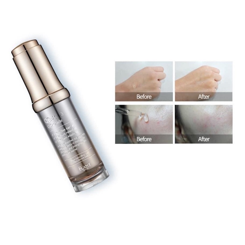 Serum Giúp Da Sáng Khỏe The Plant Base Quesera Ceramide 20ml
