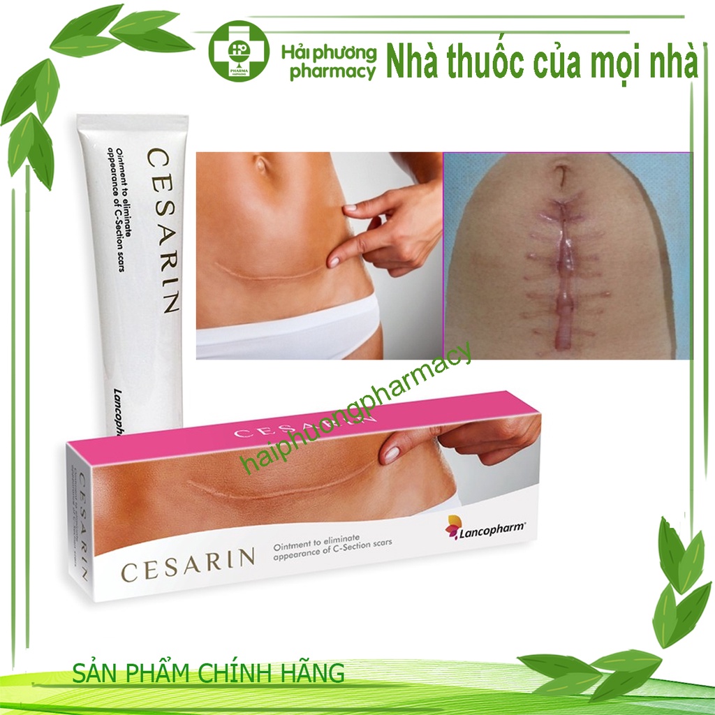 Kem Làm Mờ Sẹo Sau Phẫu Thuật Lancopharm Cesarin Ointment 30g