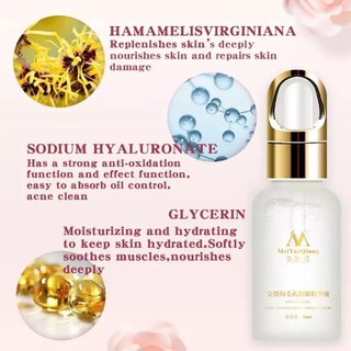Serum Hết Mụn Se Khích Lỗ Chân Lông Trắng Da