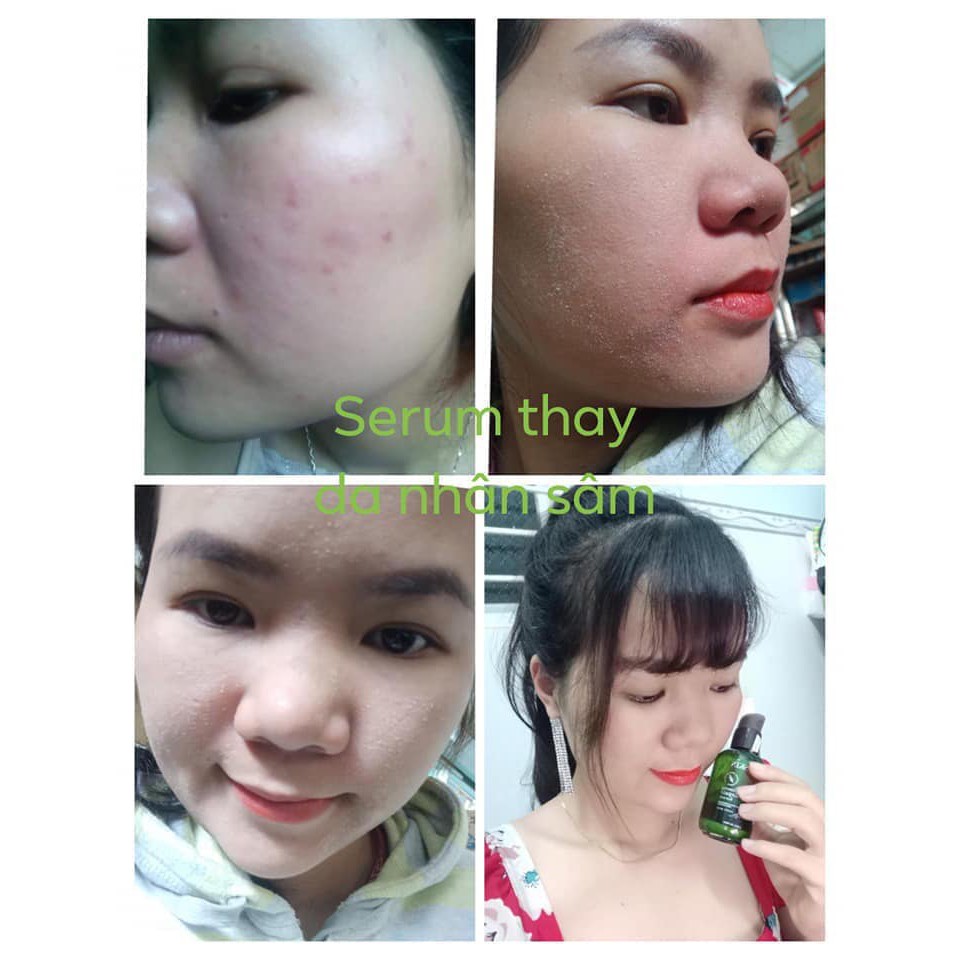 [HÀNG CHÍNH HÃNG] Serum nhân sâm tái tạo da MQ Skin 💗Freeship 💗 Tinh chất nhân sâm của Hàn Quốc | BigBuy360 - bigbuy360.vn