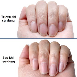 Dung Dịch Làm Mềm Da – Tẩy Da Chết Viền Móng Blue Cross USA (Cuticle Remover Chuyên Nghiệp)