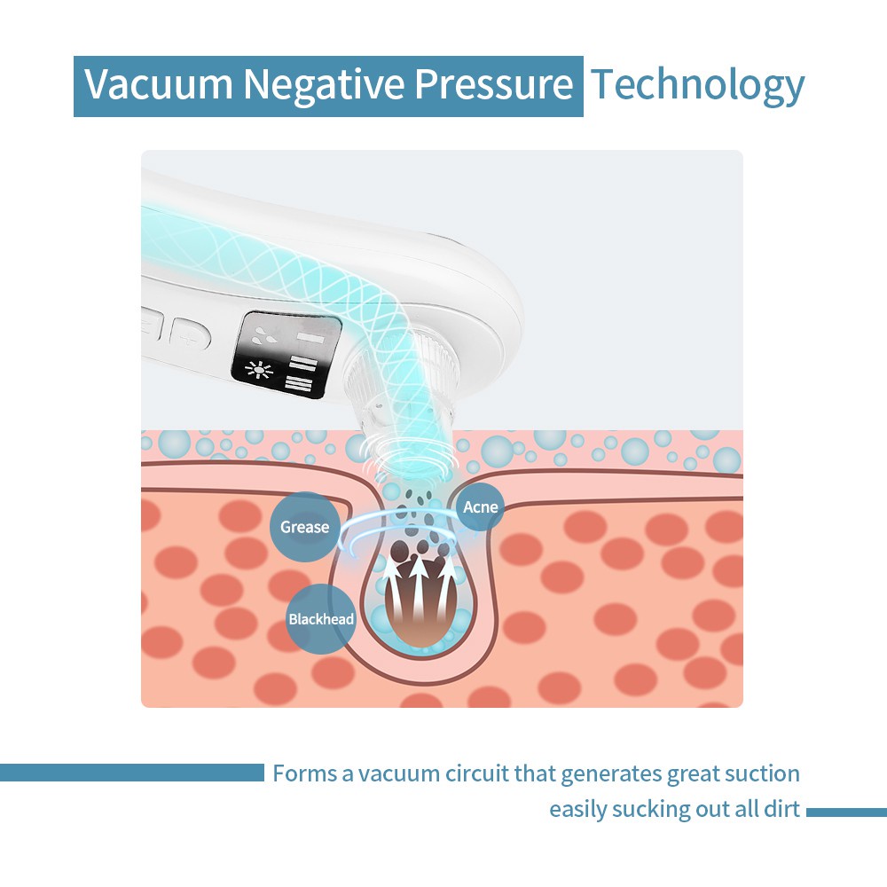 Máy Hút Mụn Đầu Đen Cầm Tay Tiện Lợi