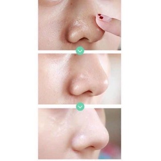 Serum Se Khít Lỗ Chân Lông