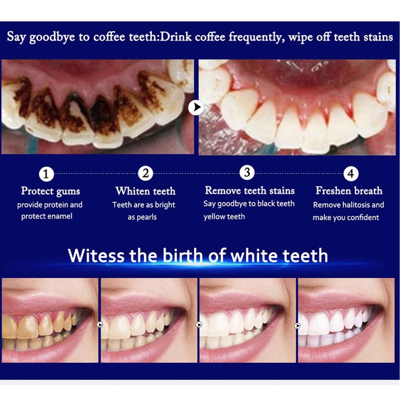 Dung Dịch Làm Trắng Răng Loại Bỏ Mảng Bám Màu Đen