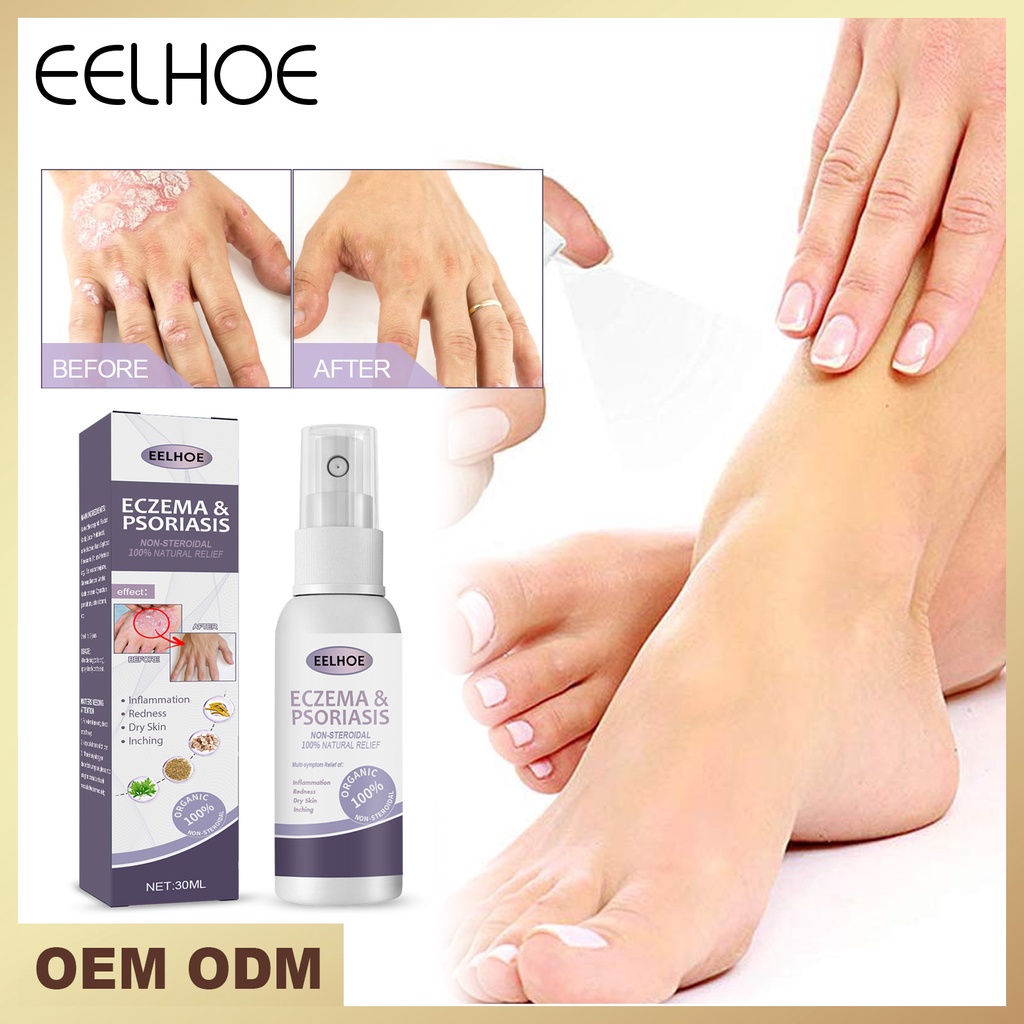 EELHOE Tinea Pedis   Mỡ Trị Chàm Da Đầu Bệnh Vẩy Nến Bàn Tay Mùi Hôi Chân Nấm Nhiều Màu Ức Chế Nấm Chống Ngứa Sản   Chăm Sóc Cơ Thể