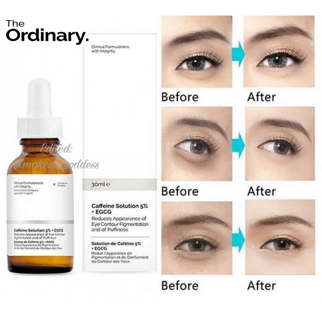 Serum The Ordinary Caffeine Solution 5% + EGCG Giảm Quầng Thâm Và Bọng Mắt 5.0