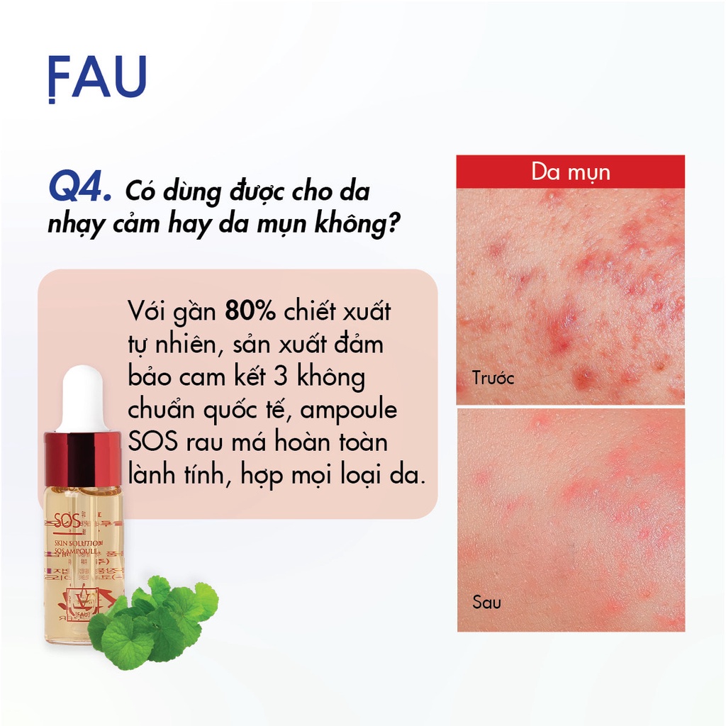 Tinh chất hỗ trợ giảm đỏ, phục hồi da-- chai 10ml