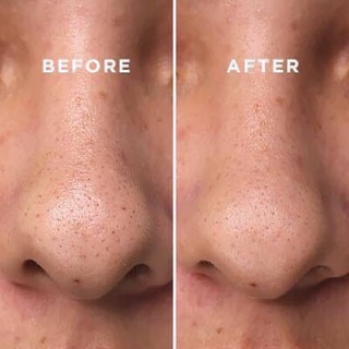 Tinh chất COSRX BHA BLACKHEAD POWER LIQUID