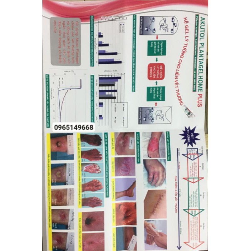 Akutol Plantagel Home Plus Dạng Gel 20g Hỗ trợ phục hồi vết bỏng và các tổn thương cấp tính