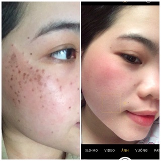 TINH CHẤT HỒNG SÂM TÁI TẠO