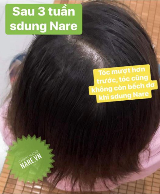 [MẪU MỚI] Kem Ủ Xả Bưởi Dừa NARE Phục Hồi Tóc Hư Tổn, Hỗ Trợ Giảm Rụng Tóc | BigBuy360 - bigbuy360.vn