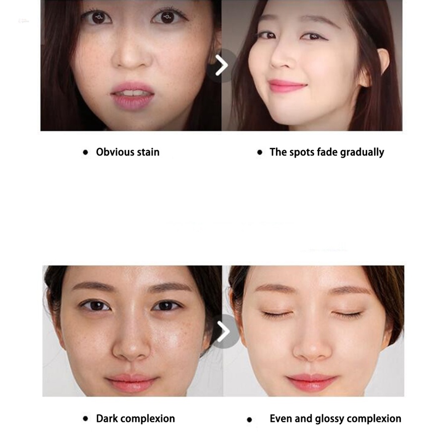 Kem Dưỡng Trắng Da Xóa Mờ Sạm Nám Tàn Nhang