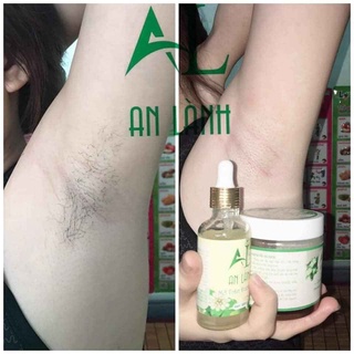 Combo triệt lông Wax + Mỡ Trăn An Lành [KÈM QUÀ TẶNG: giấy+ que + giấy nhám cao cấp + quà tặng tri ân]