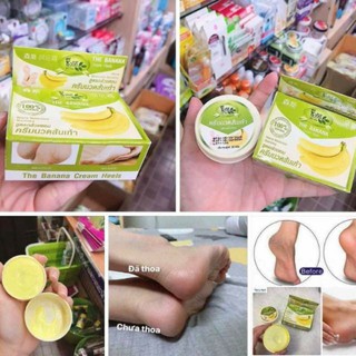 Nứt Gót Chân Chuối