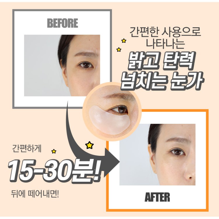 Mặt Nạ 2in1 Mờ Thâm, Cải Thiện Nếp Nhăn Vùng Mắt G9Skin Self Aesthetic Collagen Hydrogel Eye Patch 3g | Thế Giới Skin Care