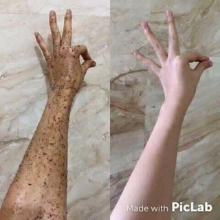 Ủ thuốc bắc trắng da 