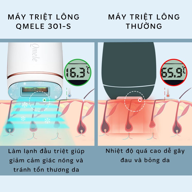 Máy Triệt Lông Lạnh IPL Mini Vĩnh Viễn Cá Nhân Tại Nhà Qmele 301-S, Công Nghệ Làm Lạnh Đầu Triệt-Thế Hệ Mới Nhất 2021