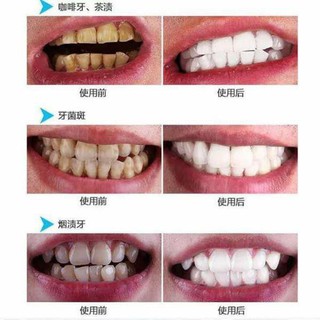 kem đánh răng baking soda siêu trắng răng