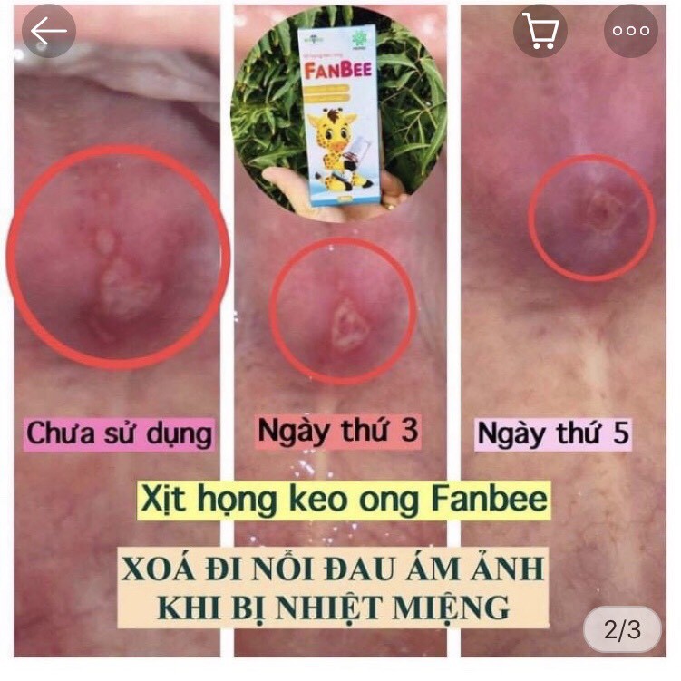 Xịt Họng Keo Ong Fanbee 20ML - Fanmec (Mua 1 Tặng 1 Hộp Khẩu Trang Cao Cấp Cho Bé)