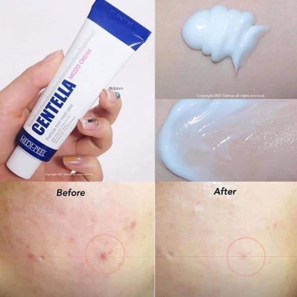 Kem Rau Má Giảm Mụn Dịu Da Medi Peel Centella Mezzo Cream TREEHOUSE SHOP